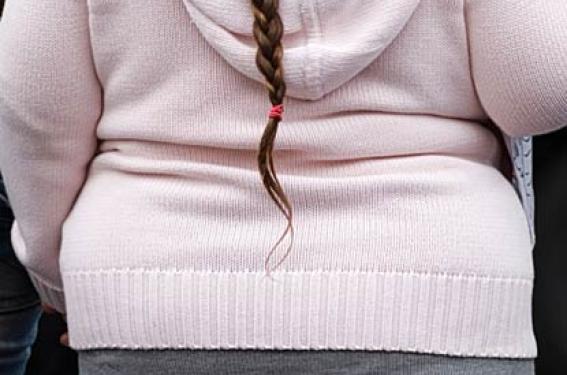 Efficacité et tolérance du sécukinumab dans le psoriasis en population pédiatrique