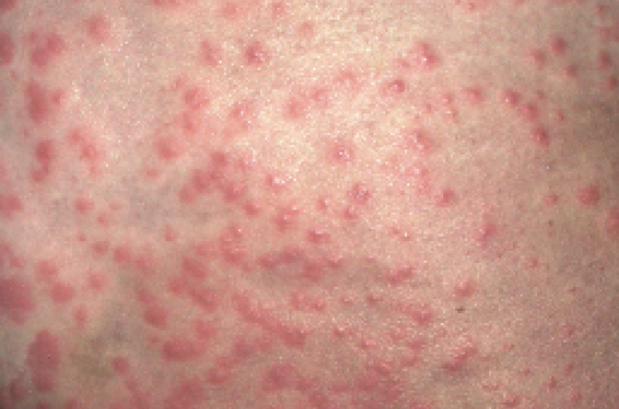 Quel diagnostic évoquer ?
