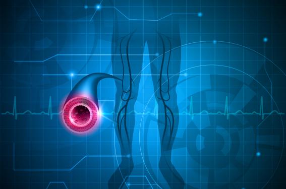 Existe-t-il une majoration du risque de thrombose veineuse sous anti-JAK ?