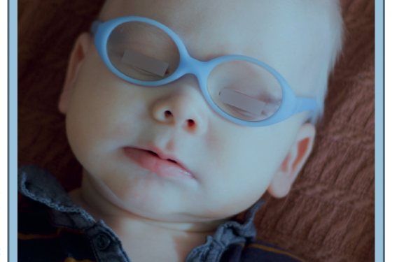 Photodermatoses de l’enfant : quand évoquer une maladie génétique ?